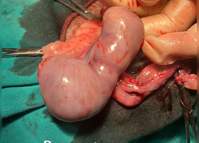 pyometra